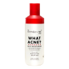 WHAT ACNE? DAILY MOISTURIZER